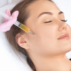 Vampire Facial
