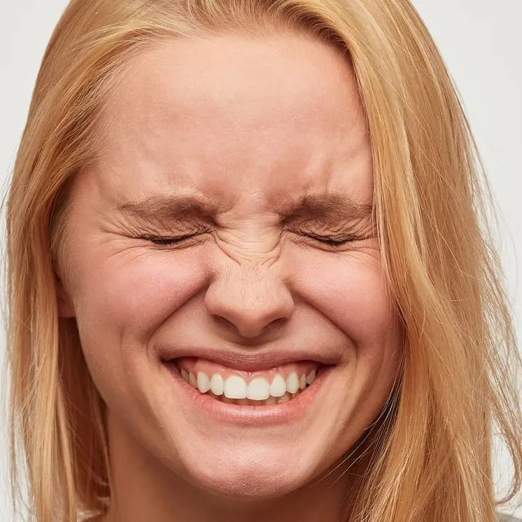 gummy smile treatment