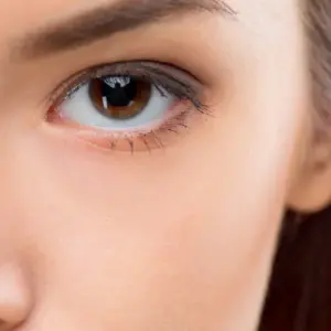 Polynucleotides Vs Tear Trough Filler: Which Is Best?