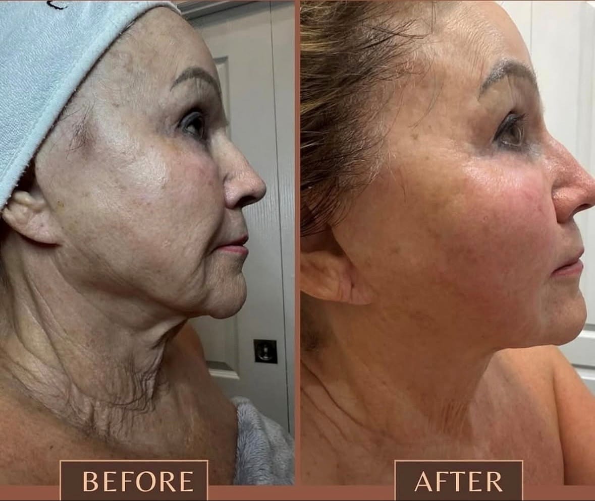 Before and After 7