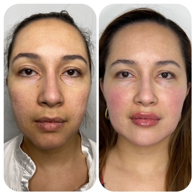 rejuvenating facial treatment