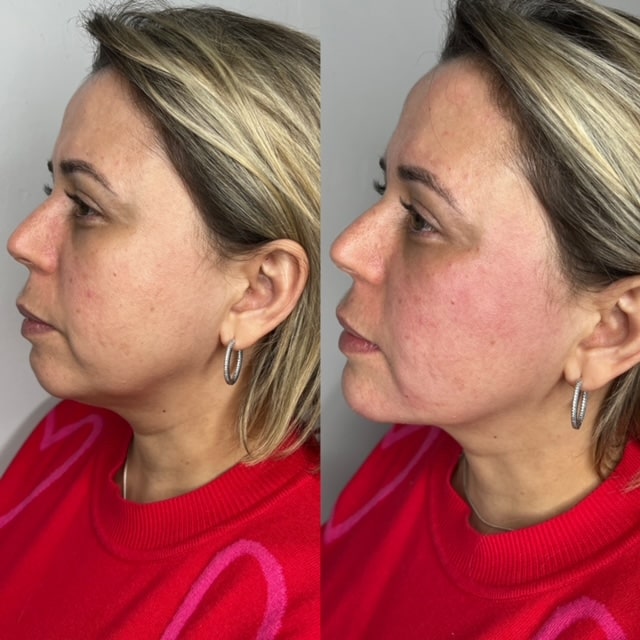 rejuvenating facial treatment